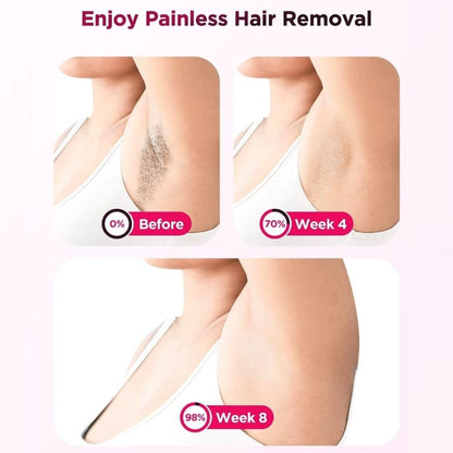 Before and after comparison of hair removal on a leg with text indicating progress over weeks.