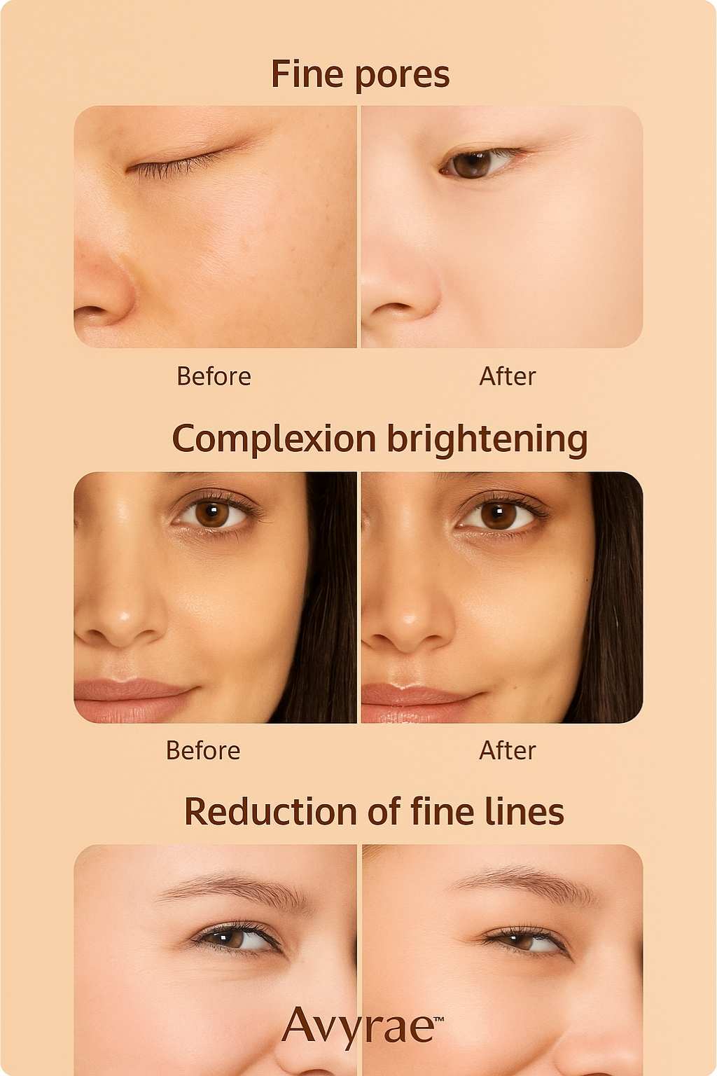 LED red light mode used on skin with Avyrae™ SculptLift device for rejuvenation and improved tone.