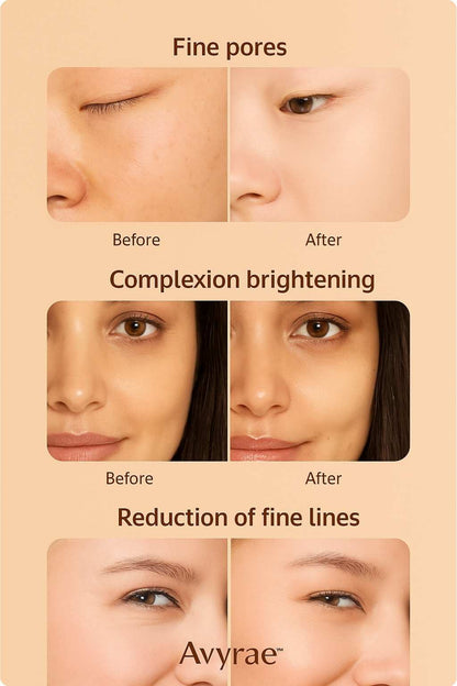 LED red light mode used on skin with Avyrae™ SculptLift device for rejuvenation and improved tone.